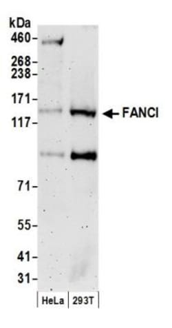 anti-FANCI, Polyclonal, Novus Biologicals 0.1mL; Unlabeled, Quantity: 0.1