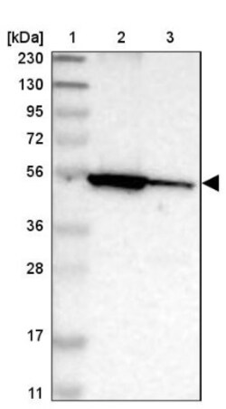 FAR1 Antibody, Novus Biologicals 0.1mL; Unlabeled:Antibodies, Polyclonal