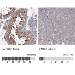 FARSB Antibody, Novus Biologicals 0.1 mL | Buy Online | Novus Biologicals | Fisher Scientific