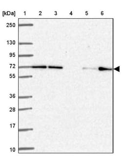 FARSB Antibody, Novus Biologicals 0.1 mL | Buy Online | Novus Biologicals | Fisher Scientific
