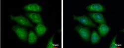 FASTKD1 Antibody, Novus Biologicals 0.1mL; Unlabeled:Antibodies, Polyclonal
