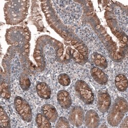 FASTKD1 Antibody, Novus Biologicals 0.1mL; Unlabeled:Antibodies, Polyclonal