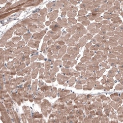 FASTKD1 Antibody, Novus Biologicals 0.1mL; Unlabeled:Antibodies, Polyclonal