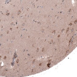 FASTKD1 Antibody, Novus Biologicals 0.1mL; Unlabeled:Antibodies, Polyclonal