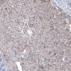 FASTKD1 Antibody, Novus Biologicals 0.1mL; Unlabeled:Antibodies, Polyclonal