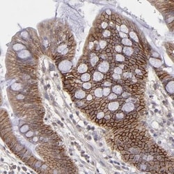 FAT1 Antibody, Novus Biologicals 0.1mL; Unlabeled:Antibodies, Polyclonal