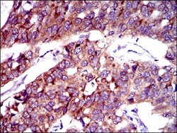 FATP2/SLC27A2 Antibody (6B3A9) - BSA Free, Novus Biologicals 0.1mL; Unlabeled:Antibodies,