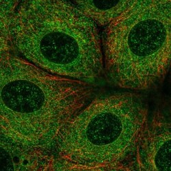 FATP3/SLC27A3 Antibody, Novus Biologicals 25 &mu;L; Unlabeled:Antibodies,