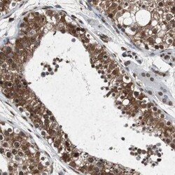 FATP3/SLC27A3 Antibody, Novus Biologicals 25 &mu;L; Unlabeled:Antibodies,