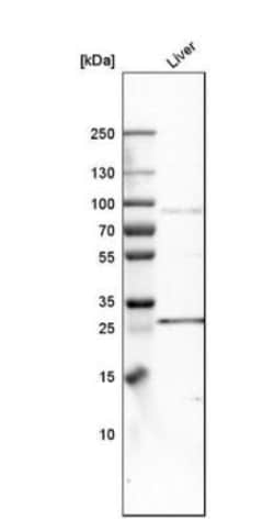 FATP3/SLC27A3 Antibody, Novus Biologicals 25 &mu;L; Unlabeled:Antibodies,