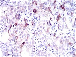 FATP5/SLC27A5 Antibody (9C4D1) - BSA Free, Novus Biologicals:Antibodies:Primary