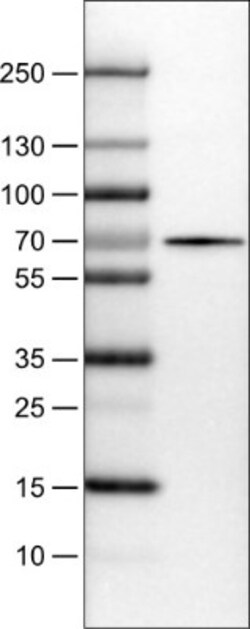 FATP5/SLC27A5 Antibody (CL0213), Novus Biologicals:Antibodies:Primary Antibodies
