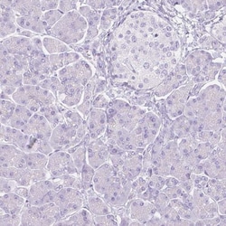 FATP5/SLC27A5 Antibody, Novus Biologicals:Antibodies:Primary Antibodies