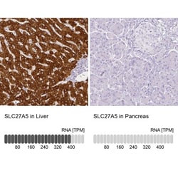 FATP5/SLC27A5 Antibody, Novus Biologicals:Antibodies:Primary Antibodies