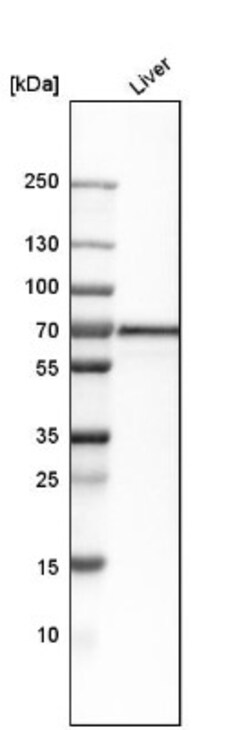 FATP5/SLC27A5 Antibody, Novus Biologicals:Antibodies:Primary Antibodies
