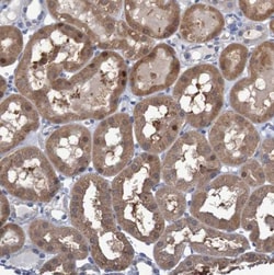 ASGPR1 Antibody, Novus Biologicals:Antibodies:Primary Antibodies