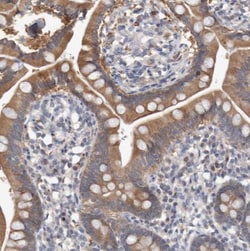 ASGPR1 Antibody, Novus Biologicals:Antibodies:Primary Antibodies