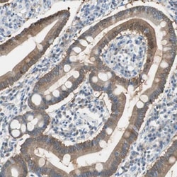 FBPase 1 Antibody, Novus Biologicals 25 &mu;L; Unlabeled:Antibodies, Polyclonal
