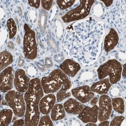 FBPase 1 Antibody, Novus Biologicals 25 &mu;L; Unlabeled:Antibodies, Polyclonal