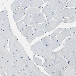 FBPase 1 Antibody, Novus Biologicals 25 &mu;L; Unlabeled:Antibodies, Polyclonal