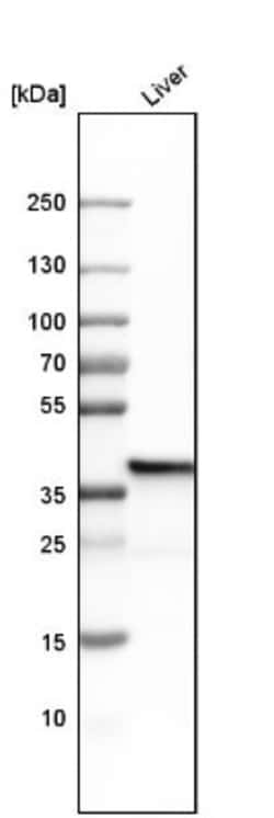 FBPase 1 Antibody, Novus Biologicals 25 &mu;L; Unlabeled:Antibodies, Polyclonal