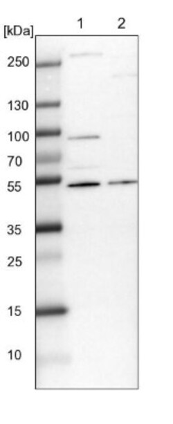 FBRS Antibody, Novus Biologicals 25 &mu;L; Unlabeled:Antibodies, Polyclonal