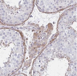 FBXL13 Antibody, Novus Biologicals 25 &mu;L, Unlabeled:Antibodies, Polyclonal