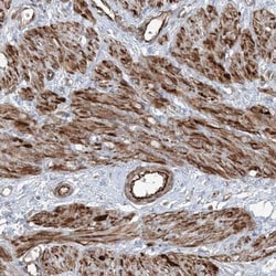 FBXL17 Antibody, Novus Biologicals:Antibodies:Primary Antibodies