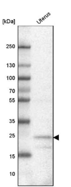 FBXL22 Antibody, Novus Biologicals:Antibodies:Primary Antibodies