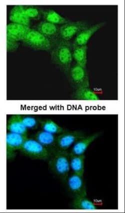 FBXL3 Antibody, Novus Biologicals 0.1mL; Unlabeled:Antibodies, Polyclonal