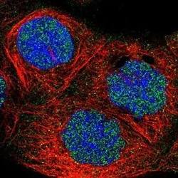 FBXO11 Antibody, Novus Biologicals:Antibodies:Primary Antibodies