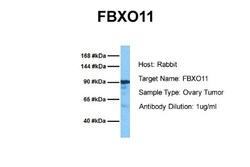 FBXO11 Antibody, Novus Biologicals 0.05mg; Unlabeled:Antibodies, Polyclonal