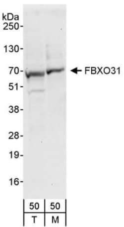 FBXO31 Antibody, Novus Biologicals 0.1mL; Unlabeled:Antibodies, Polyclonal