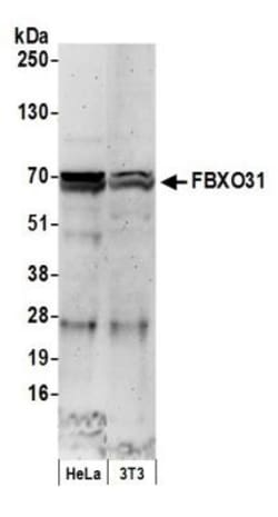 FBXO31 Antibody, Novus Biologicals 0.1mL; Unlabeled:Antibodies, Polyclonal