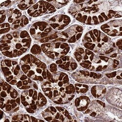 FBXO33 Antibody, Novus Biologicals 0.1mL; Unlabeled:Antibodies, Polyclonal