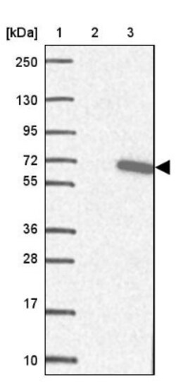FBXO33 Antibody, Novus Biologicals 0.1mL; Unlabeled:Antibodies, Polyclonal