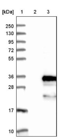 FBXO44 Antibody, Novus Biologicals:Antibodies:Primary Antibodies