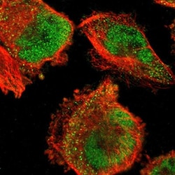 FBXO8 Antibody, Novus Biologicals 0.1mL; Unlabeled:Antibodies, Polyclonal