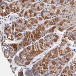 FBXO8 Antibody, Novus Biologicals 0.1mL; Unlabeled:Antibodies, Polyclonal
