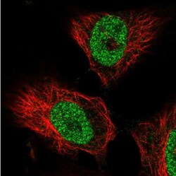 FBXW2 Antibody, Novus Biologicals 25 &mu;L, Unlabeled:Antibodies, Polyclonal