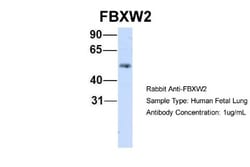FBXW2 Antibody, Novus Biologicals 100&mu;L; Unlabeled:Antibodies, Polyclonal