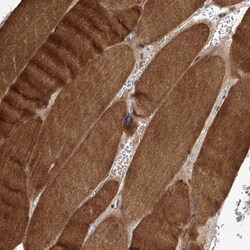 FBXW8 Antibody, Novus Biologicals 0.1mL; Unlabeled:Antibodies, Polyclonal
