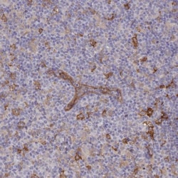 FCHO2 Antibody, Novus Biologicals 25 &mu;L | Buy Online | Novus Biologicals | Fisher Scientific