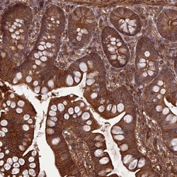 FCHSD1 Antibody, Novus Biologicals 0.1mL; Unlabeled:Antibodies, Polyclonal