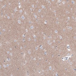 FCHSD2 Antibody, Novus Biologicals 0.1mL; Unlabeled:Antibodies, Polyclonal