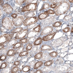 FCHSD2 Antibody, Novus Biologicals 0.1mL; Unlabeled:Antibodies, Polyclonal
