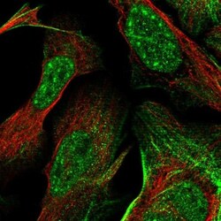 FCP1 Antibody, Novus Biologicals:Antibodies:Primary Antibodies