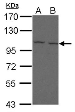 FCRL5/FcRH5/IRTA2 Antibody, Novus Biologicals™