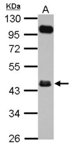 FCRLA/FCRLM1 Antibody, Novus Biologicals 0.1mL; Unlabeled:Antibodies, Polyclonal