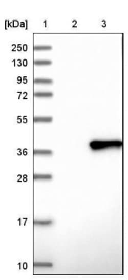 FCRN/FCGRT Antibody, Novus Biologicals 0.1mL; Unlabeled:Antibodies, Polyclonal